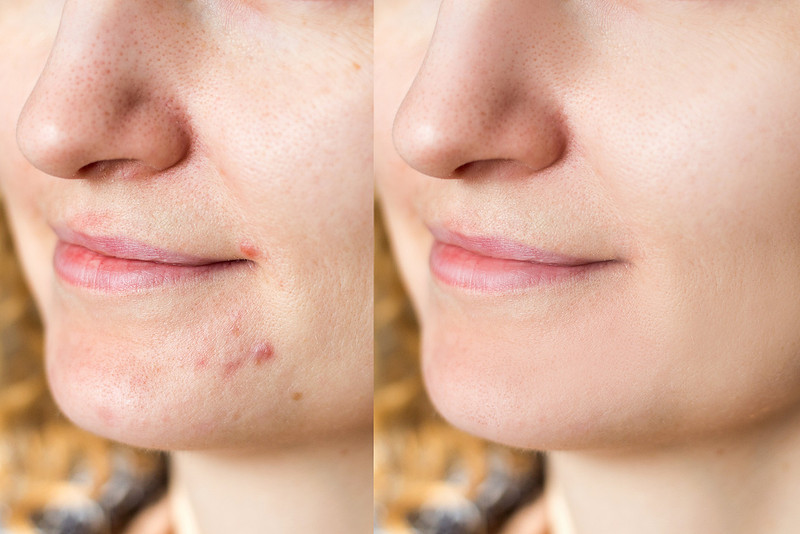 MJCollins Photography | Edit vs. Retouch - what is the difference?
